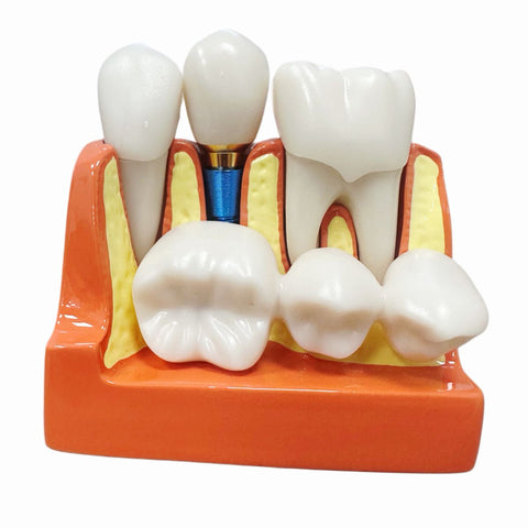 Modelo De Dientes