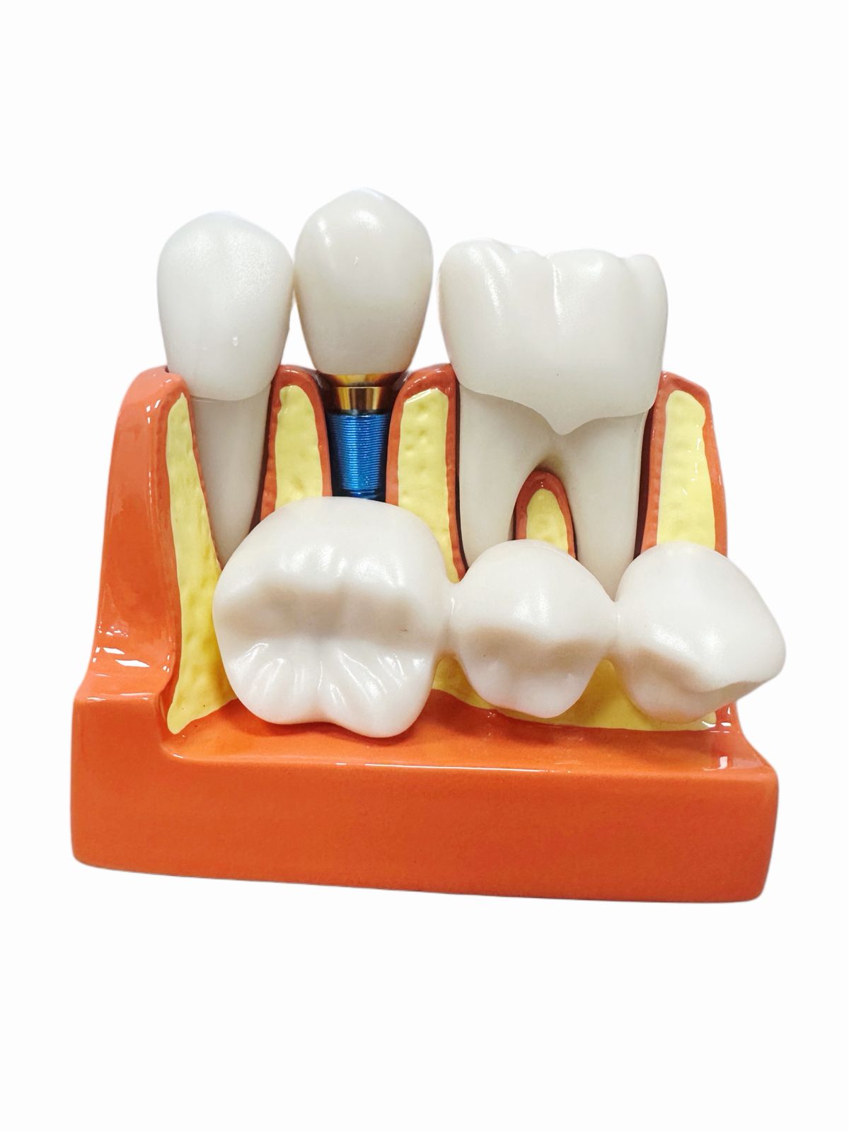 Modelo De Dientes