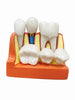 Modelo De Dientes