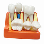 Modelo De Dientes