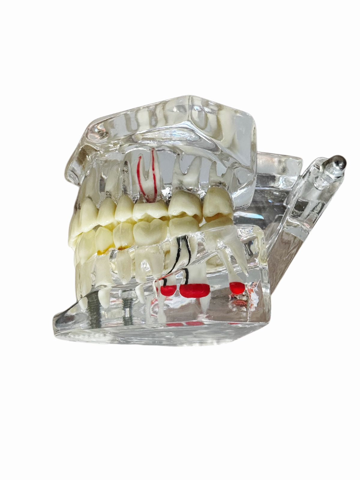 Modelo Dental Transparente