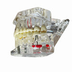 Modelo Dental Transparente