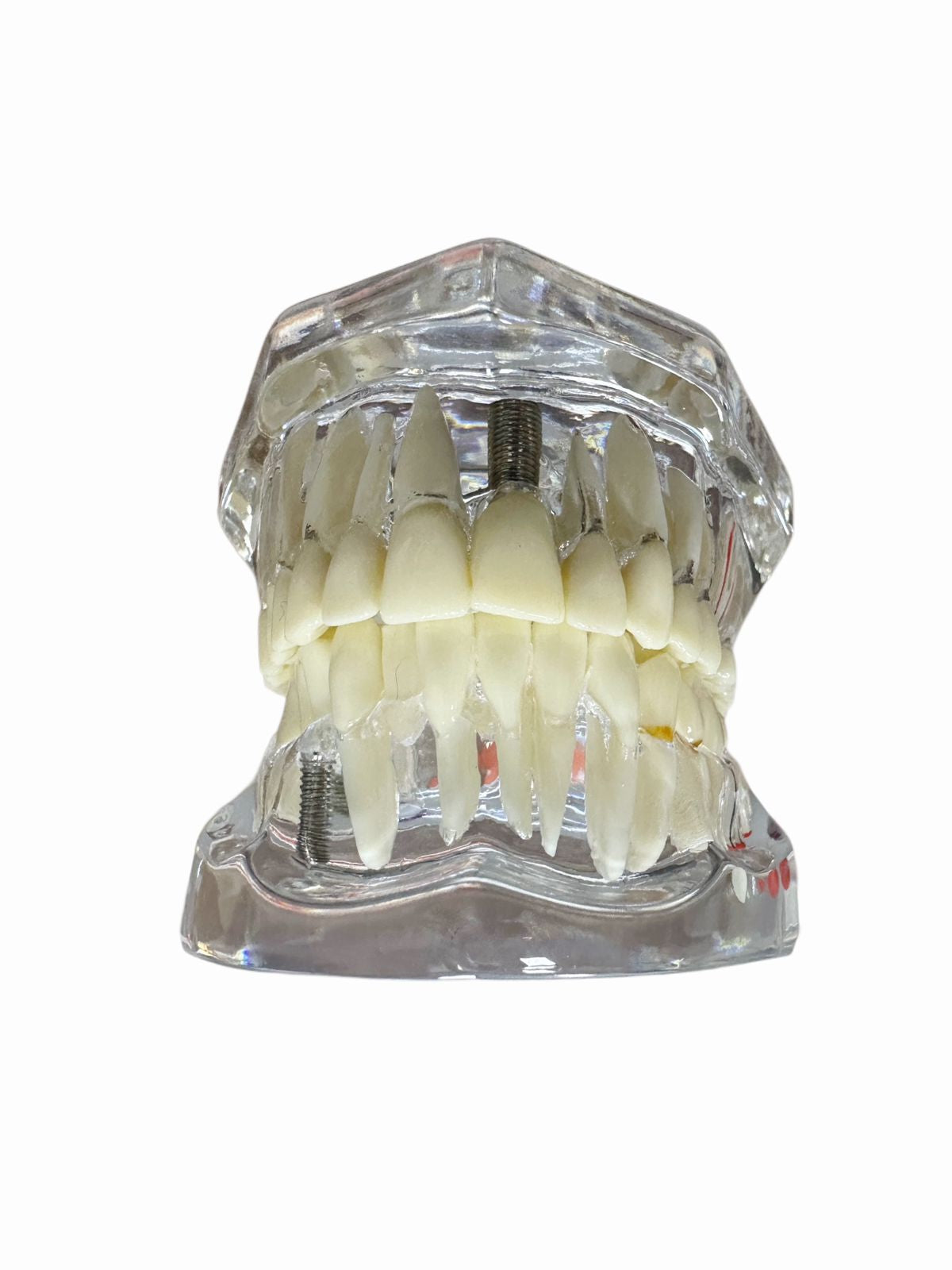 Modelo Dental Transparente