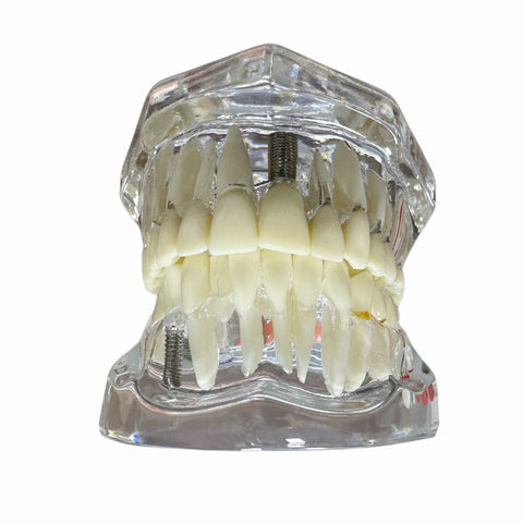 MODELO DENTAL TRANSPARENTE